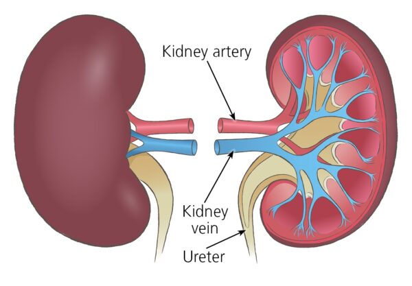 Urinary Problem